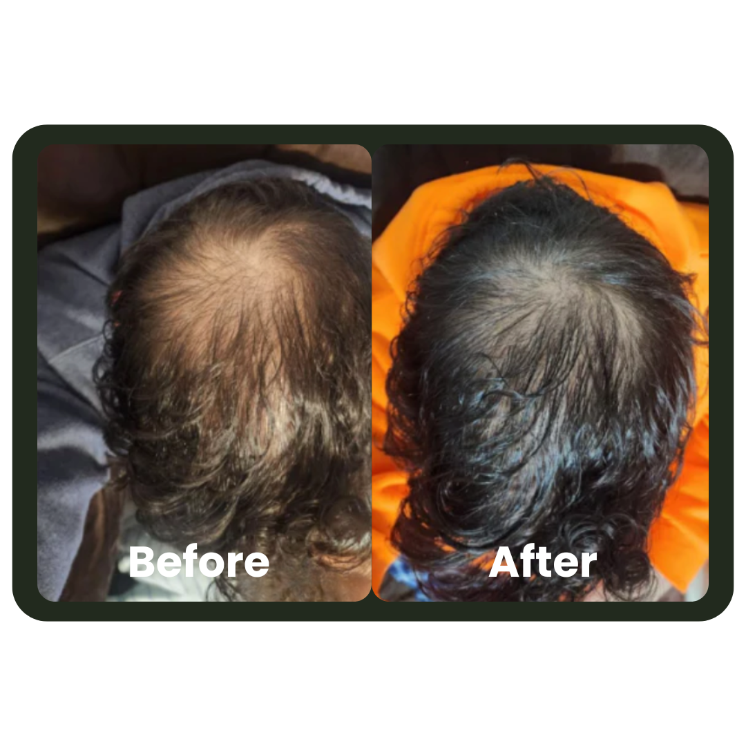 Cleava ™ Hair Growth Roll-On Serum