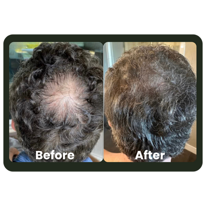 Cleava ™ Hair Growth Roll-On Serum