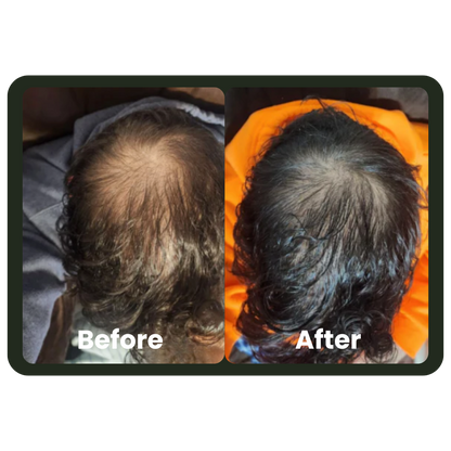 Cleava ™ Hair Growth Roll-On Serum